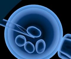 Advanced Fertility Treatments - Well advanced equipments