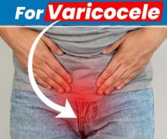 Varicocele treatment in homeopathic medicine