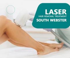 Laser Hair Removal Treatment South Webster