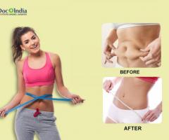 Liposuction Clinic in Hyderabad at Docplus India