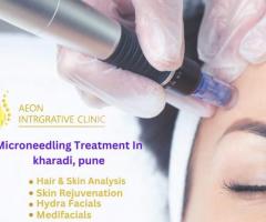 The Ultimate Guide to Microneedling Treatment in Pune
