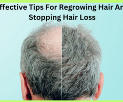 Preventative Measures for Hair Loss and Hair Regrowth.