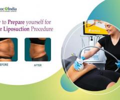 Laser Liposuction Treatment In Hyderabad: Doc Plus India