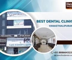 FMS Dental is Best Dental Clinic in Vanasthalipuram | Best Dentist in Vanasthalipuram