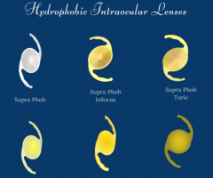 Intraocular Lenses or IOL Implant by Appasamy Associates