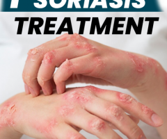 Homeopathic remedies for psoriasis treatment