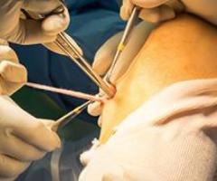 joint replacement surgeon & specialist in Indore