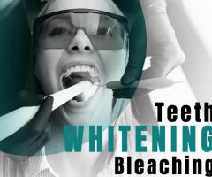 Teeth Whitening Bleaching - 1