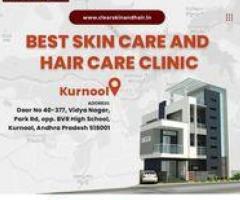 skin specialist clinic in kurnool