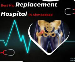 Find the Best Hospital for Hip Replacement in Ahmedabad: Our Ultimate Guide