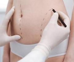 Get your plastic surgery done by the best surgeons at Sugiderma
