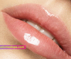 Enhance Your Smile with Lip Filler Treatments