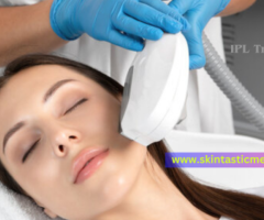 IPL Treatment for Revitalize Your Skin
