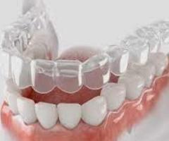 7 Reason To Choose Retainers