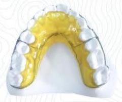 Transform Smiles with Precision: China Orthodontic Lab's Begg Appliance Solutions - 1