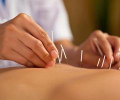 Soothing the Gut - Acupuncture IBS Treatment Unveiled!