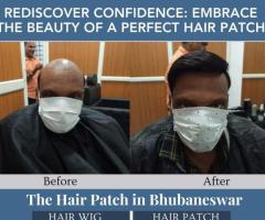 Best Hair Patch Services in Bhubaneswar