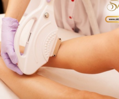 Experience the Pinnacle of Laser Hair Removal in Riverside