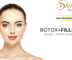 Revitalize Your Appearance with Botox in Riverside - 1