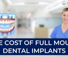 Discover the Benefits of Dental Implants at Dental Wellness Center - 1