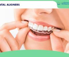 Transform Your Smile with Clear Aligners | dental wellness center - 1