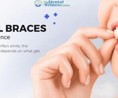 Affordable Dental Braces Cost in Ahmedabad | Dental wellness center