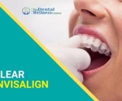 Transform Your Smile with Invisalign at The Dental Wellness Centre