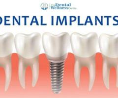 Dr. Vishal Patel - Expert Dental Implants in Ahmedabad