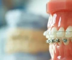 clear braces for teeth | Amini Ortho