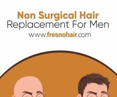 best non surgical hair replacement - 1