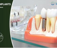 Restore Your Smile with World-Class Dental Implants at The Dental Wellness Center