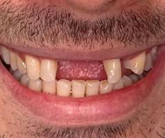 VIP Dental Implants Houston | Board-Certified Periodontist
