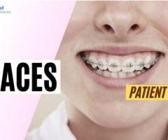Best Dentist in Ahmedabad   | Implants | Braces | Gum Care | Dental Wellness Center - 1