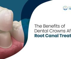 Comprehensive Root Canal Therapy at Our Dental Wellness Center