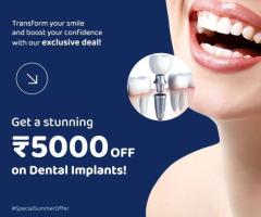 Revitalize Your Smile: Seegehalli's Top Dental Implant Services