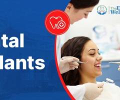 Restore Your Smile with Affordable Dental Implants in Ahmedabad | Dental Wellness Center