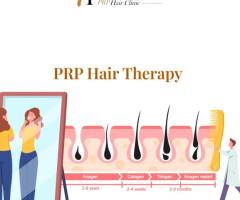 PRP Hair Therapy Fresno