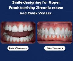Transform Your Smile: Top-rated Dental Clinic in Seegehalli