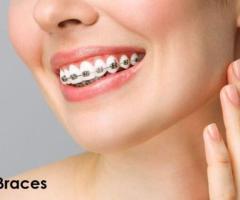 Embrace Your New Smile: Premier Dental Braces Treatment in Ahmedabad  | Dental Wellness centre
