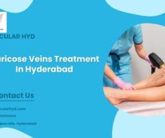 Varicose Veins Treatment In Hyderabad