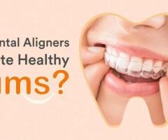 Transform Your Smile with Clear Aligners at Our Dental Wellness Center