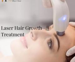 laser hair therapy Fresno