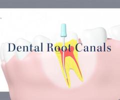 Restore Dental Health with Root Canal Treatment at Dental Wellness Center