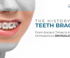 Expert Dental Braces Treatment in Ahmedabad | Top Orthodontist at Dental Wellness Center