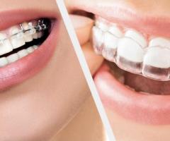 Top Smile Makeover Services in Houston
