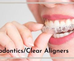 Achieve a Perfect Smile with Clear Aligners | Dental Wellness Center