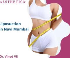 Scuplting Serenity: Experience Liposuction Excellence with Dr. Vinod Vij in Navi Mumbai