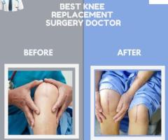 Best Knee replacement surgery doctor