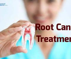 Best Root Canal Specialists in Ahmedabad | Dental Wellness Center
