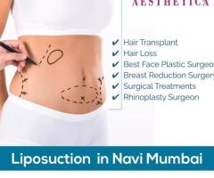 Transform Your Body with Liposuction by Dr. Vinod Vij in Navi Mumbai